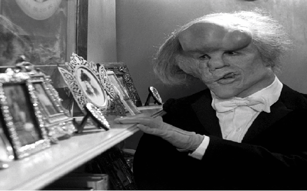 Elephant Man